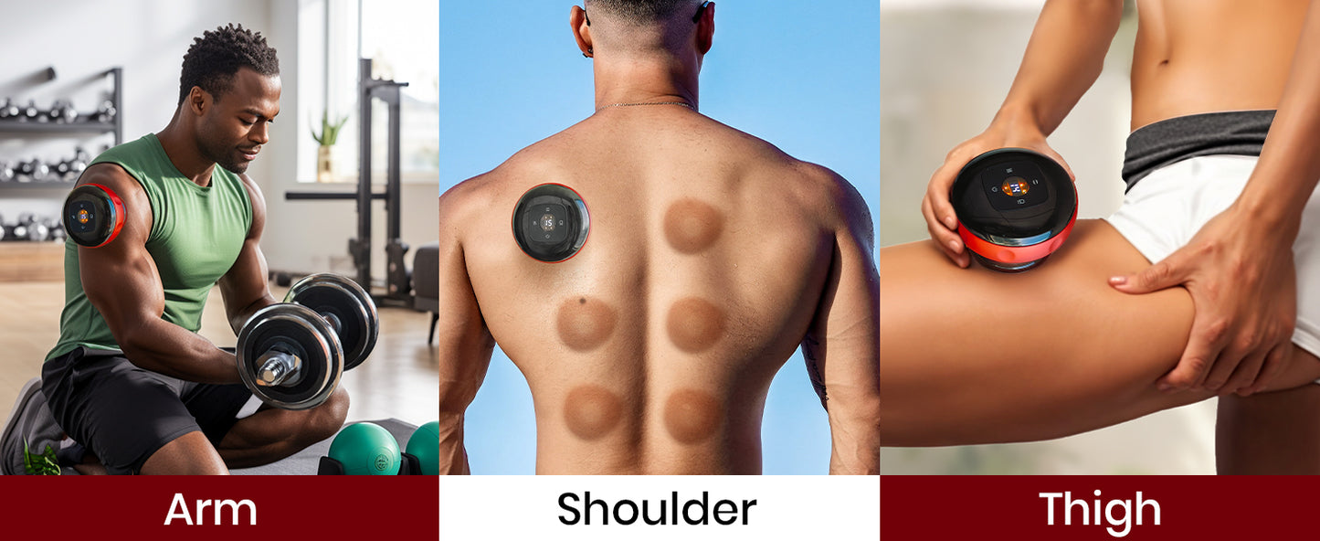 💆 Electric Cupping Therapy Device | 5-in-1 Relief for Tension, Pain & Recovery
