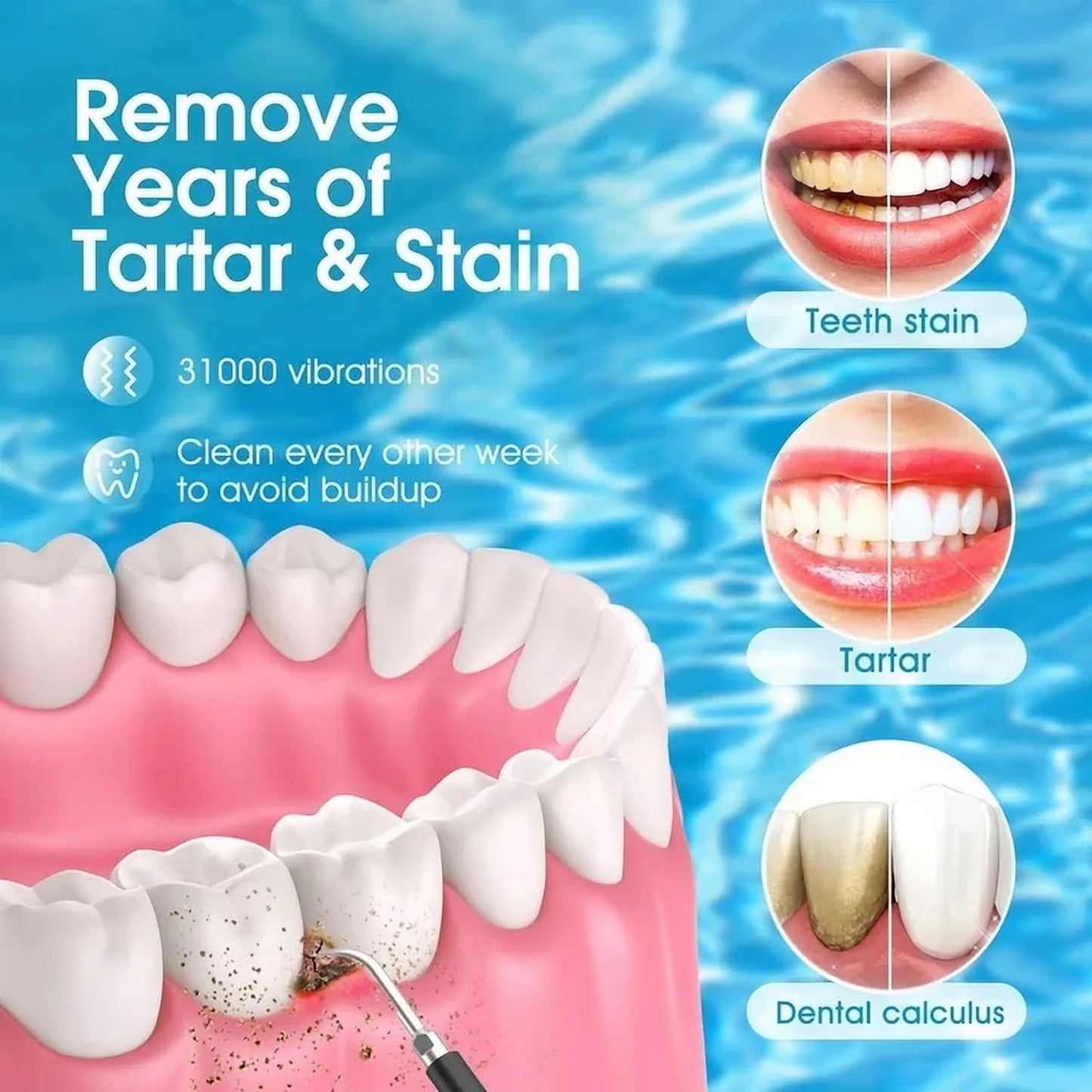 Dental Plaque & Tartar Remover with Mouth Mirror – 5 Modes & 2 Replaceable Heads